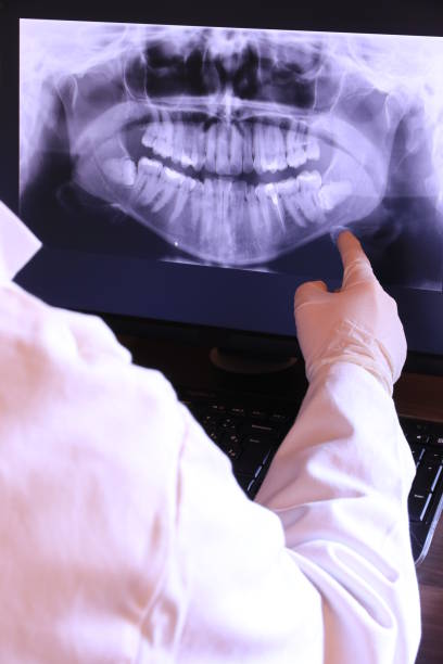 Best Chipped Tooth Repair Near Me  in Eastlake, OH